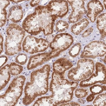 Anti-TIMM13 antibody produced in rabbit，100UL，HPA048985-100UL，Sigma