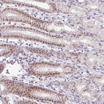 Anti-FAM65C antibody produced in rabbit，100UL，HPA051823-100UL，Sigma