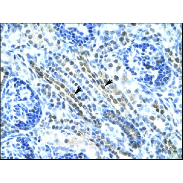 Anti-ANKRD11 antibody produced in rabbit，100UL，AV33542-100UL，Sigma