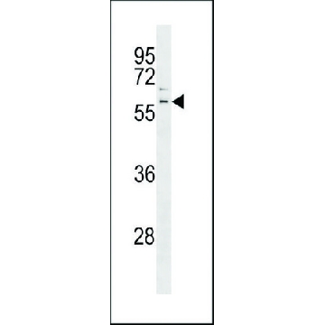 ANTI-PARKIN(C-TERMINAL) antibody produced in rabbit，400UL，SAB1306670-400UL，Sigma