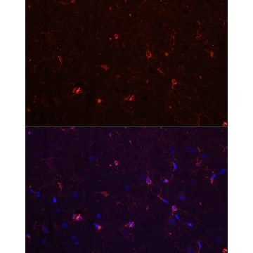Anti-AIF1/IBA1 Antibody, clone 4S8I1, Rabbit Monoclonal，100UL，SAB5702256-100UL，Sigma