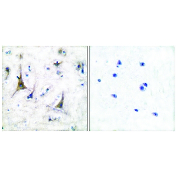 抗-PGP9.5 兔抗，100UG，SAB4503057-100UG，Sigma