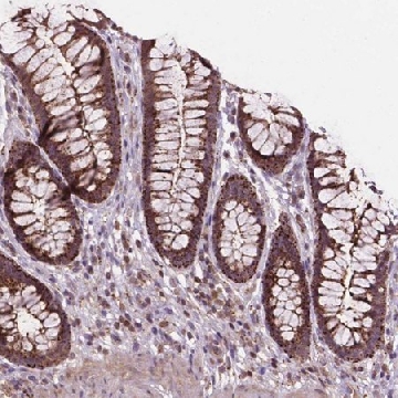 Anti-CHMP4A antibody produced in rabbit，100UL，HPA068473-100UL，Sigma