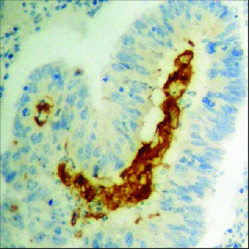 Anti-phospho-STAT2 (pTyr⁶⁹⁰) antibody produced in rabbit，100UG，SAB4503836-100UG，Sigma