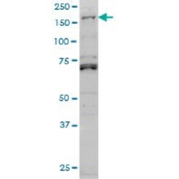 Monoclonal Anti-LMTK3 antibody produced in mouse，50UG，WH0114783M2-50UG，Sigma