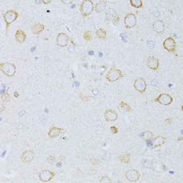 Anti-CD63 antibody produced in rabbit，100UL，SAB5700799-100UL，Sigma