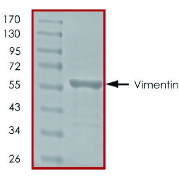 Vimentin, His tagged human，50UG，SRP5150-50UG，Sigma
