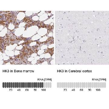 Anti-HK3 antibody produced in rabbit，100UL，HPA056743-100UL，Sigma