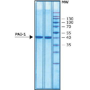 血纤维蛋白溶酶原激活物抑制剂1(PAI-1) 人，25UG，A8111-25UG，Sigma