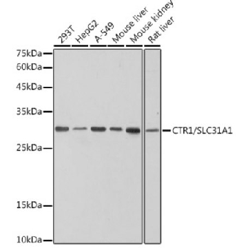 Anti-CTR1/SLC31A1 Antibody, clone 4C10C5, Rabbit Monoclonal，100UL，SAB5701994-100UL，Sigma