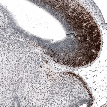 Anti-BARHL1 antibody produced in rabbit，100UL，HPA004809-100UL，Sigma