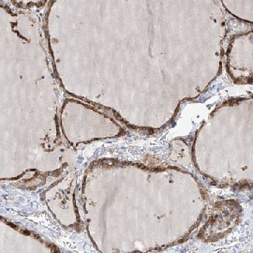 Anti-SLC43A3 antibody produced in rabbit，100UL，HPA030551-100UL，Sigma