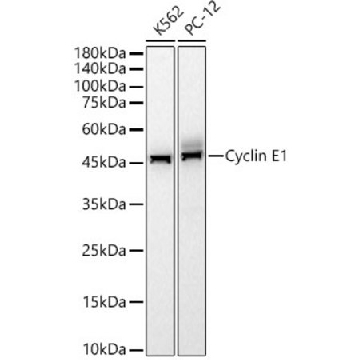 Anti-Cyclin E1 Antibody, clone 1L1W8, Rabbit Monoclonal，100UL，SAB5702036-100UL，Sigma