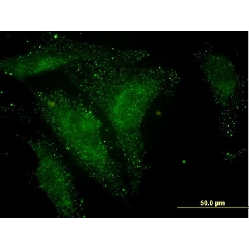Monoclonal Anti-NELL1 antibody produced in mouse，100UG，WH0004745M1-100UG，Sigma