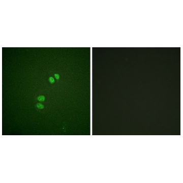 Anti-PLK1 antibody produced in rabbit，100UG，SAB4502211-100UG，Sigma