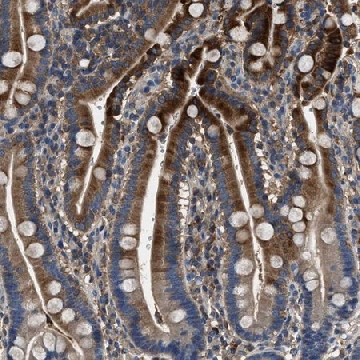 Anti-BLOC1S1 antibody produced in rabbit，100UL，HPA021381-100UL，Sigma