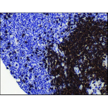 Anti-CD79A antibody, Rabbit monoclonal，100UL，SAB5500072-100UL，Sigma