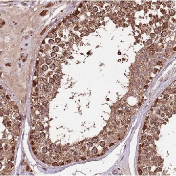 Anti-IL17RD antibody produced in rabbit，100UL，HPA043550-100UL，Sigma