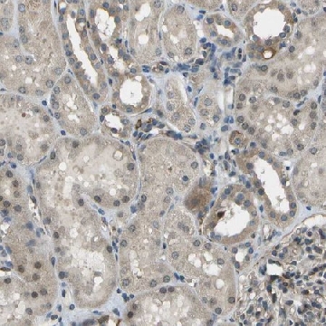 Anti-CTIF antibody produced in rabbit，100UL，HPA016865-100UL，Sigma