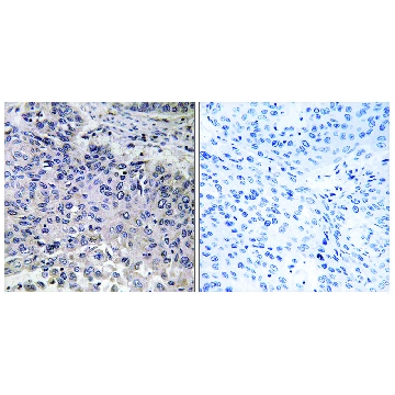 Anti-C1QC antibody produced in rabbit，100UG，SAB4502993-100UG，Sigma