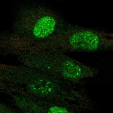 Anti-TERT antibody produced in rabbit，100UL，HPA054641-100UL，Sigma