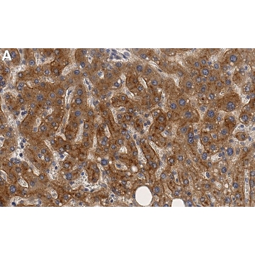Anti-ABCA1 Antibody, clone 1J11 ZooMAb® Rabbit Monoclonal，4X25UL，ZRB2057-4X25UL，Sigma