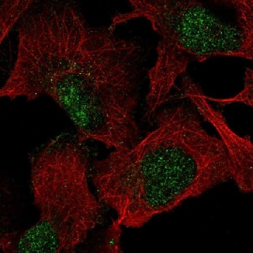 Anti-VGLL1 antibody produced in rabbit，100UL，HPA064616-100UL，Sigma