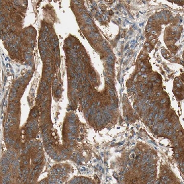 Anti-ROCK2 antibody produced in rabbit，100UL，HPA007459-100UL，Sigma