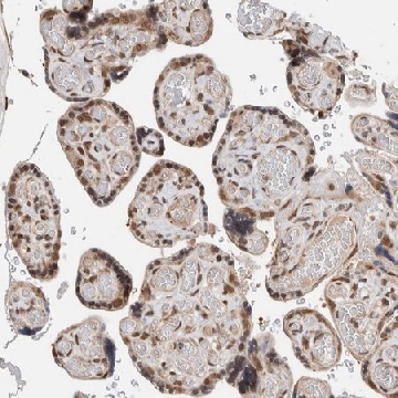 Anti-TNRC18 antibody produced in rabbit，100UL，HPA024251-100UL，Sigma
