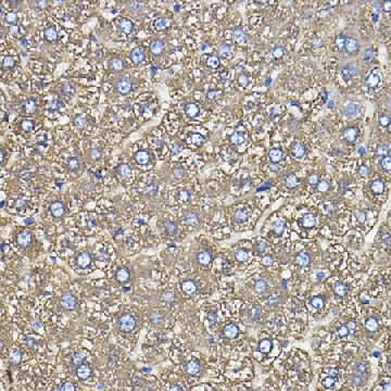 Anti-Ceruloplasmin antibody produced in rabbit，100UL，SAB5701394-100UL，Sigma