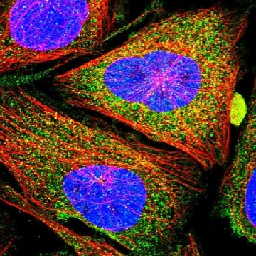 Anti-CCBE1 antibody produced in rabbit，100UL，HPA041361-100UL，Sigma