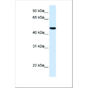 Anti-SLC2A6 antibody produced in rabbit，100UL，SAB2102200-100UL，Sigma