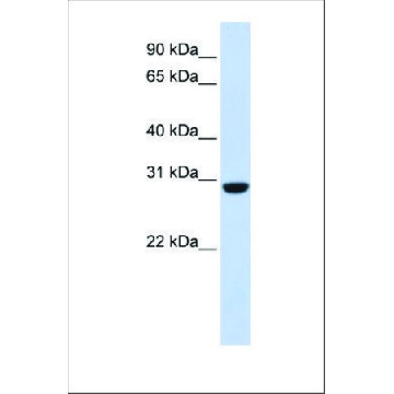 Anti-RCAN1，100UL，SAB2108705-100UL，Sigma