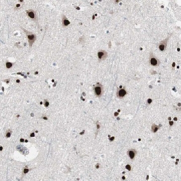 Anti-POGZ antibody produced in rabbit，100UL，HPA006800-100UL，Sigma