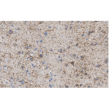 Anti-GAD67 Antibody, clone 1G10.2 ZooMAb® Mouse Monoclonal，4X25UL，ZMS5406-4X25UL，Sigma