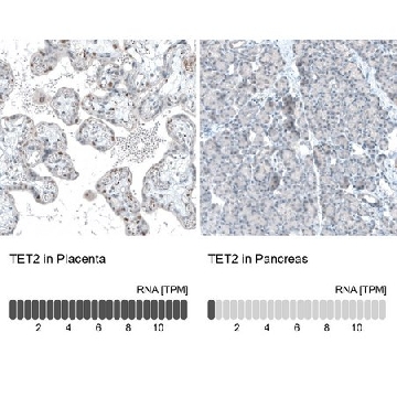 Monoclonal Anti-TET2 antibody produced in mouse，100UL，AMAB91439-100UL，Sigma