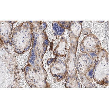 Anti-GNA-11 (G alpha 11) Antibody, clone 1F16 ZooMAb® Rabbit Monoclonal，25UL，ZRB1446-25UL，Sigma