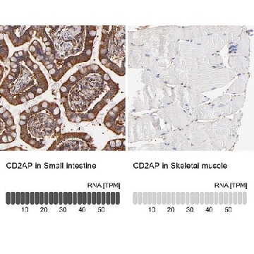 Anti-CD2AP antibody produced in rabbit，100UL，HPA003326-100UL，Sigma