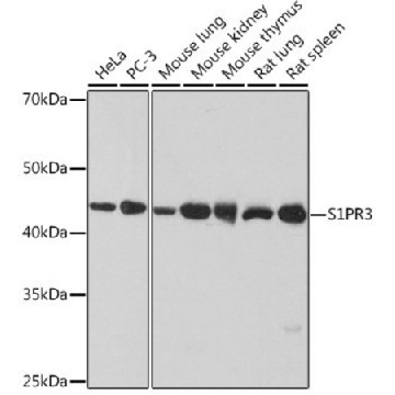 Anti-S1PR3 antibody produced in rabbit，100UL，SAB5701065-100UL，Sigma