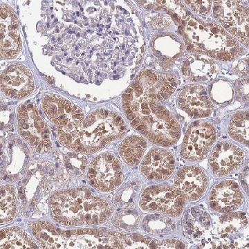 Anti-EIF4EBP3 antibody produced in rabbit，100UL，HPA045537-100UL，Sigma