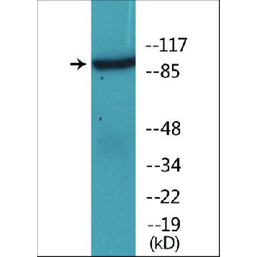 抗-磷酸化-IL-4R/CD124 (pTyr⁴⁹⁷) 兔抗，100UG，SAB4504241-100UG，Sigma