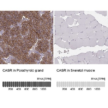 Anti-CASR antibody produced in rabbit，100UL，HPA039686-100UL，Sigma