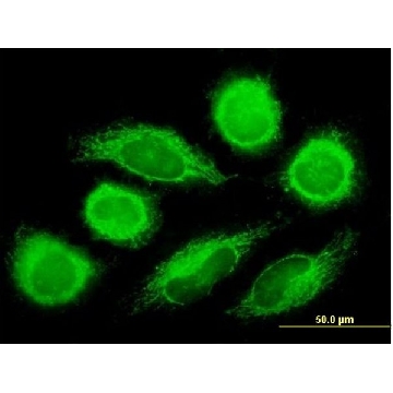 Anti-DNAJC11 antibody produced in mouse，50UG，SAB1400629-50UG，Sigma
