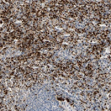抗-PPBP 兔抗，100UL，HPA008354-100UL，Sigma