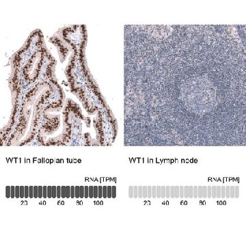 Anti-WT1 antibody produced in mouse，100UL，AMAB91840-100UL，Sigma
