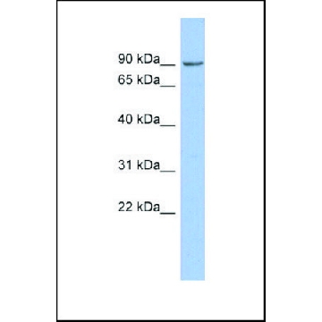 抗-NPHP1 兔抗，100UL，SAB2104055-100UL，Sigma