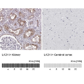 Anti-LAD1 antibody produced in rabbit，100UL，HPA028732-100UL，Sigma