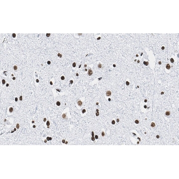 Anti-Histone H2B Antibody, clone 4O11 ZooMAb® Rabbit Monoclonal，4X25UL，ZRB1624-4X25UL，Sigma