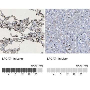 Anti-LPCAT1 antibody produced in rabbit，100UL，HPA022268-100UL，Sigma