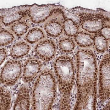 Anti-RBM42 antibody produced in rabbit，100UL，HPA043671-100UL，Sigma
